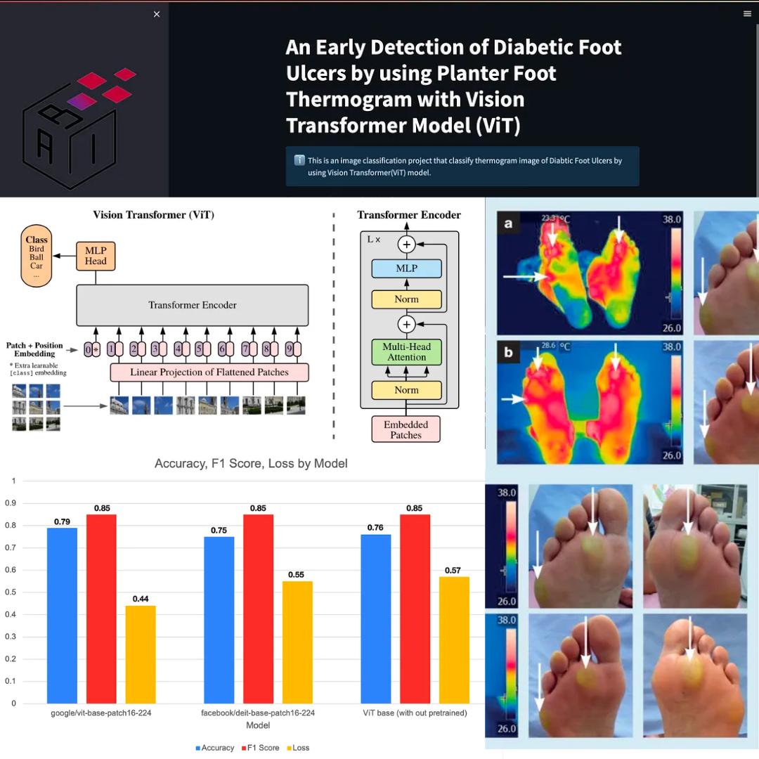 Diabetic Foot Ulcers Classification by using planter foot Thermogram with Vision Transformer (ViT)