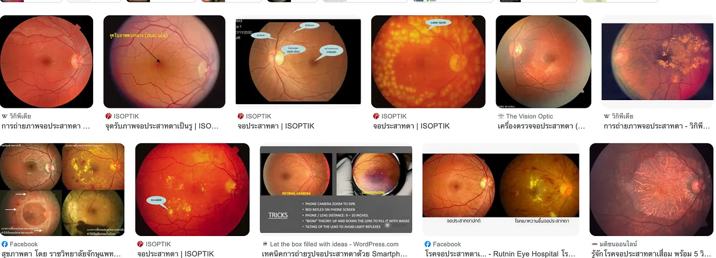 Ocular Disease Intelligent Recognition (ODIR)13