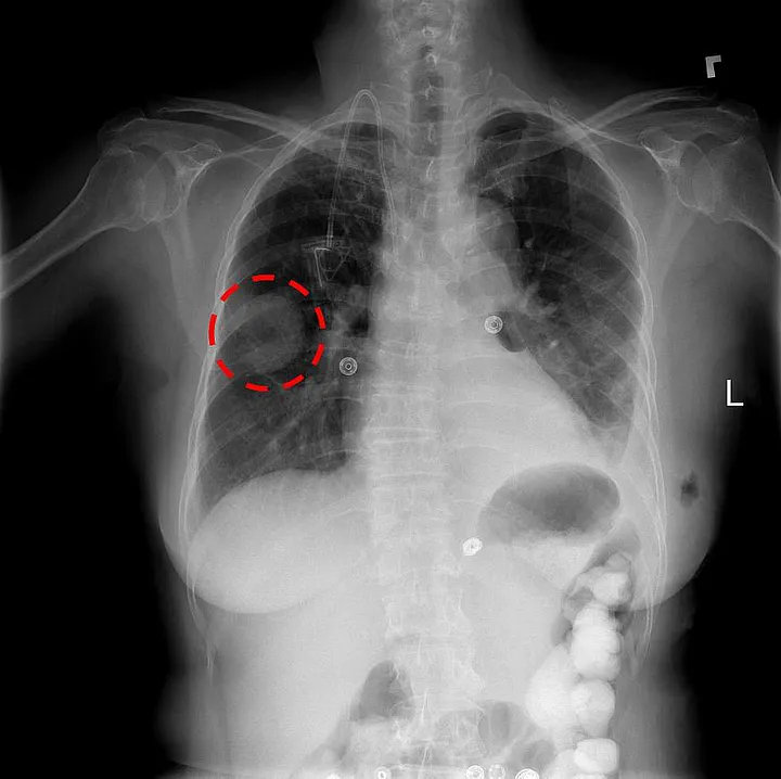 Multi label x-ray image classification